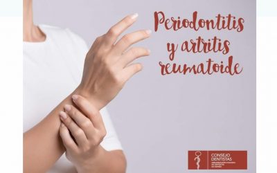 Periodontitis y Artritis reumatoide